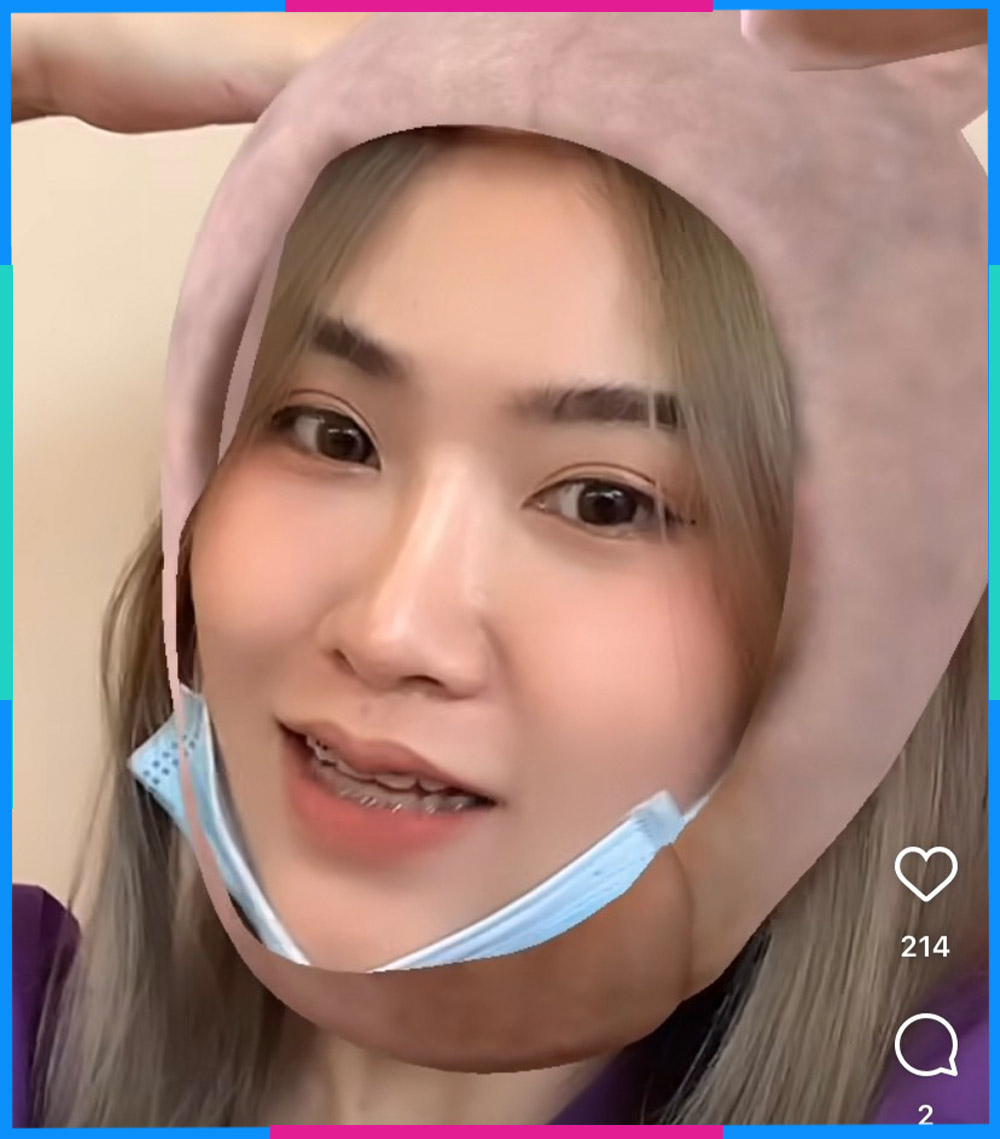 Filter Instagram mặt mày nạ Bunny Hat